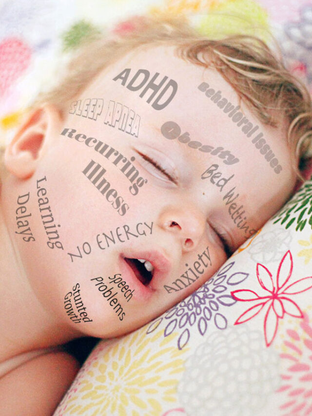 What is Sleep Apnea , its symptoms and causes?